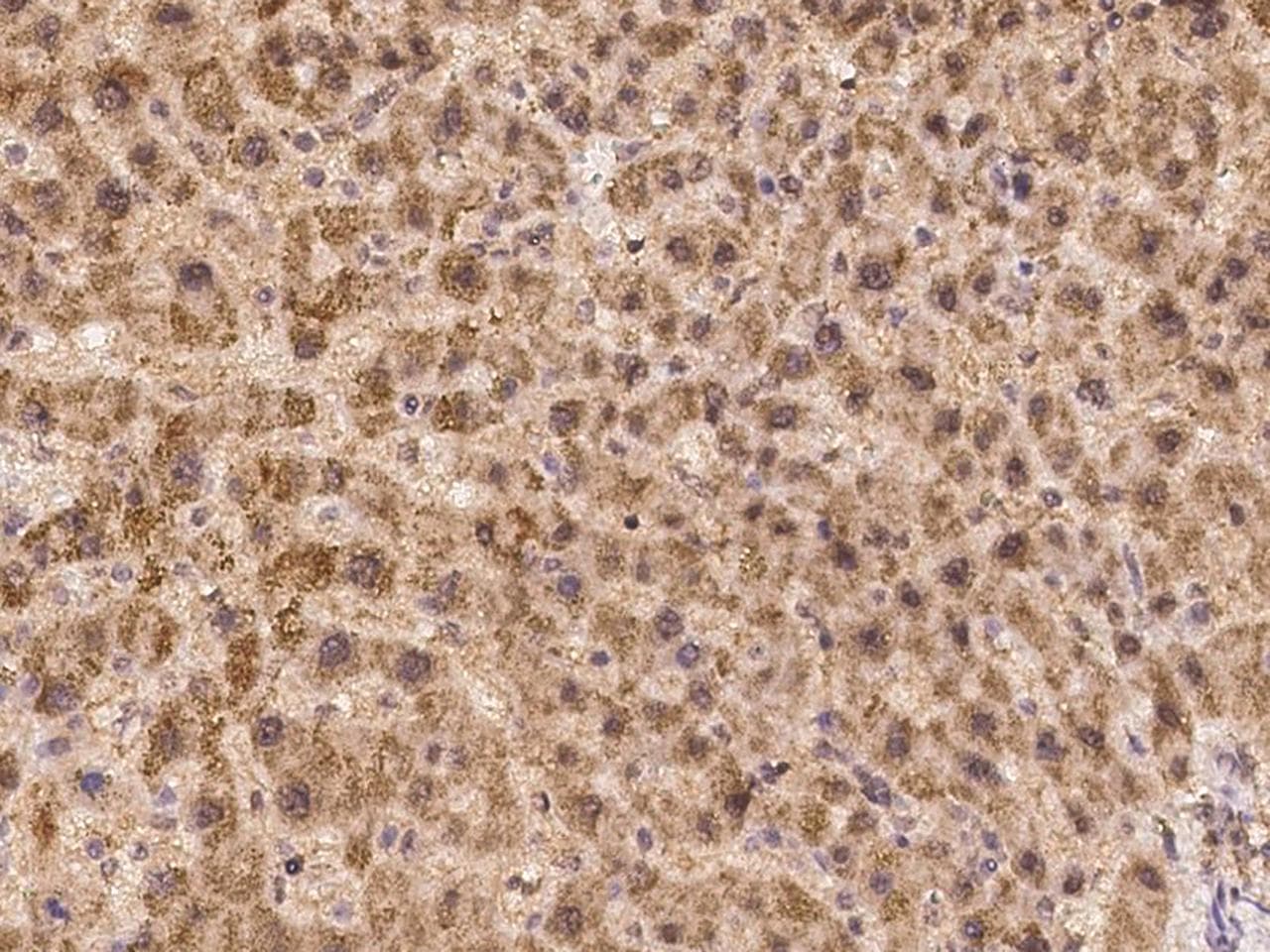 ACTA1 / Skeletal Muscle Actin Antibody (Preservative Free)