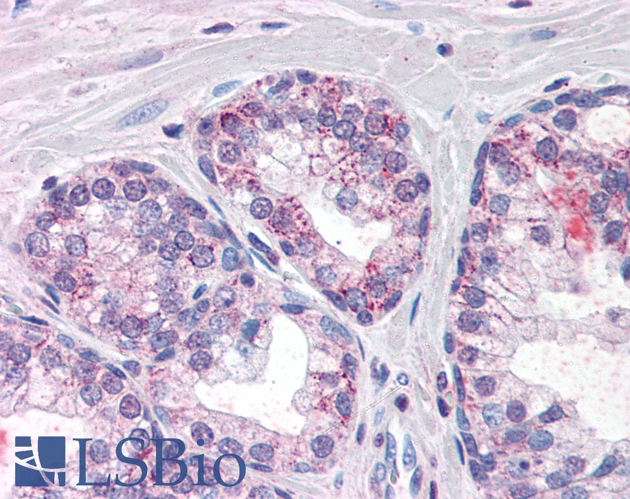 IHC-plus™ PDE11A Antibody (aa455-468)