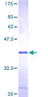 Human CDK2AP1 / DOC1 Protein (Recombinant GST)