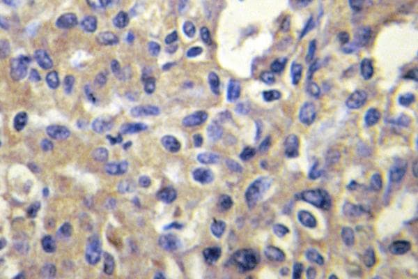 Polyclonal Rabbit anti-Human MELK Antibody (Asn449, IHC, IF)
