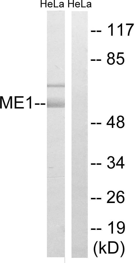 Polyclonal Rabbit anti-Human ME1 / Malate Dehydrogenase Antibody (aa468-517, WB)