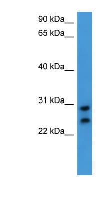 CEACAM7 Antibody (aa142-191)