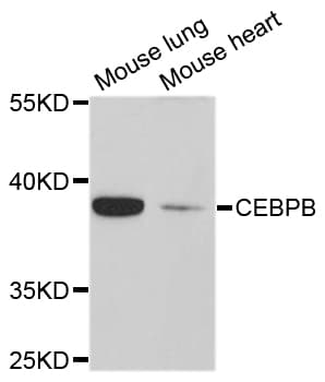 Polyclonal Rabbit anti-Human C/EBP Beta / CEBPB Antibody (WB)
