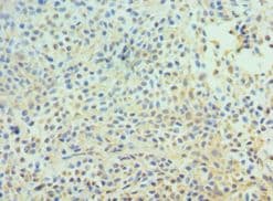 APC6 / CDC16 Antibody (aa371-620)
