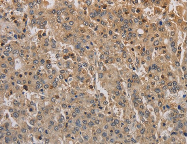 ADO Antibody