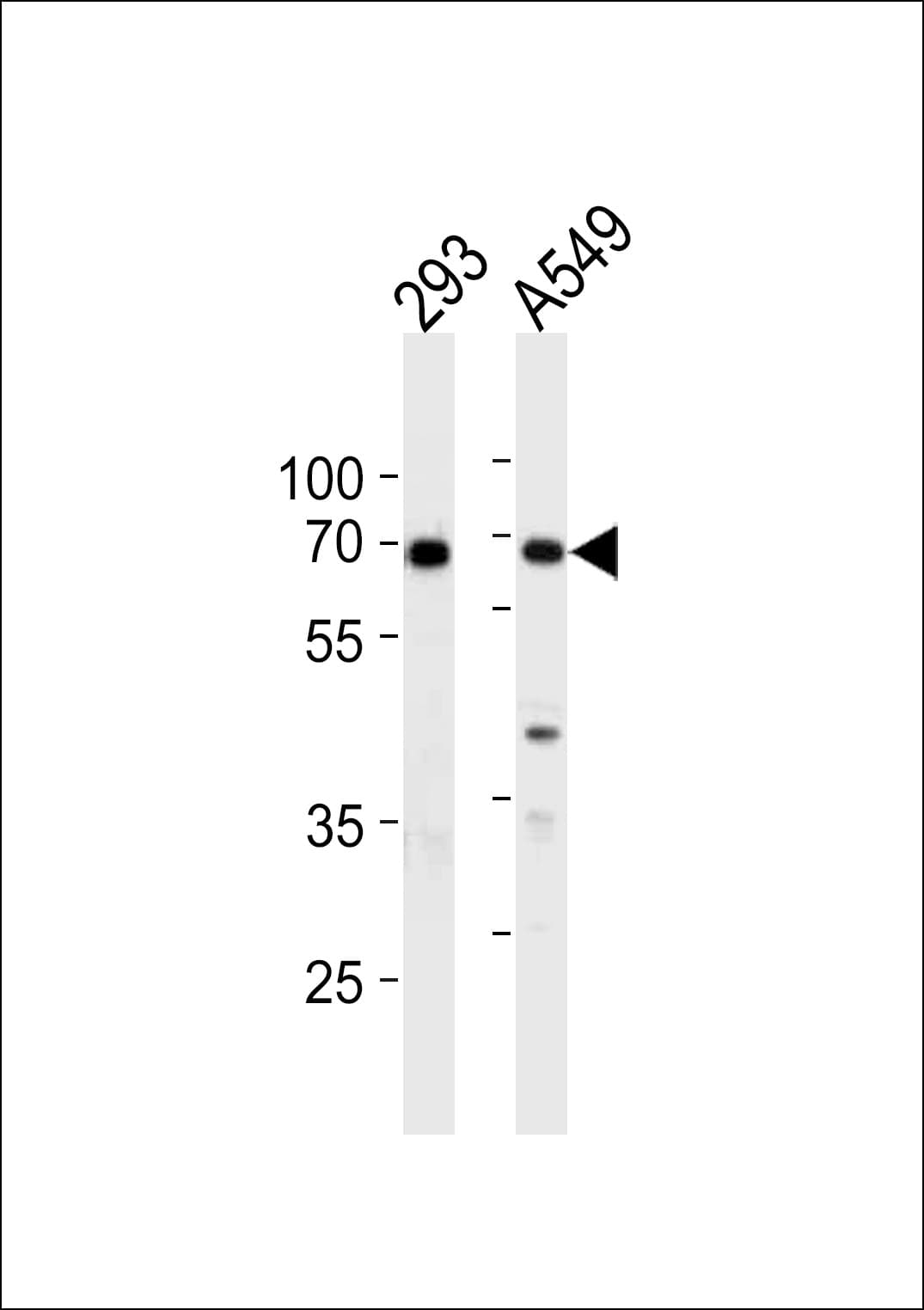 Polyclonal Rabbit anti-Human XRCC6 / Ku70 Antibody (aa228-254, IHC, IF, WB)