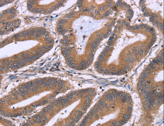 NRG1 / Heregulin / Neuregulin Antibody (aa 90-103 isoform 1)
