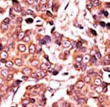 CDC25A Antibody (phospho-Ser278)