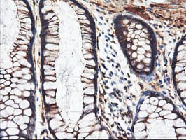 PFKP Antibody (clone OTI1F2)