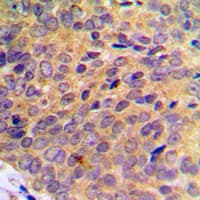 Polyclonal Rabbit anti-Human UBE1L / UBA7 Antibody (C-Terminus, IHC, WB)