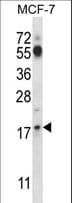 Polyclonal Rabbit anti-Human SSSCA1 / p27 Antibody (aa9-37, WB)