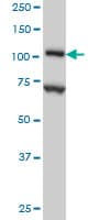 DPYD / DPD Antibody (clone 7D4)
