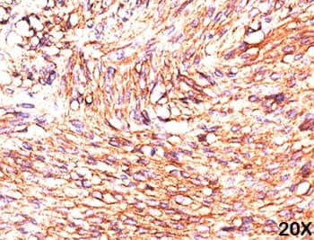ANO1 / DOG1 / TMEM16A Antibody (clone DG1/447)