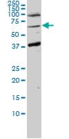 UBXD9 / ASPL Antibody (clone 3D10-1D11)