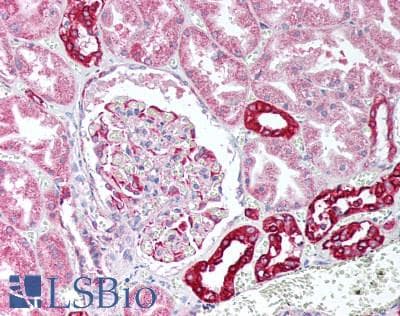 IHC-plus™ PMAIP1 / NOXA Antibody