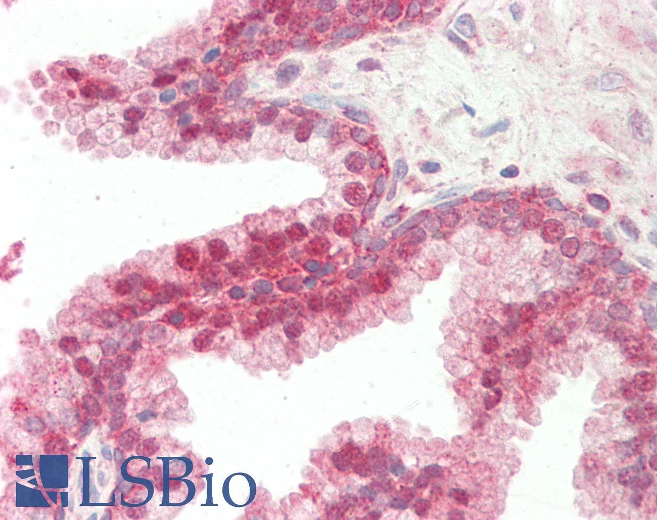 IHC-plus™ Monoclonal Mouse anti-Human EEF2 / Elongation Factor 2 Antibody (IHC, WB)
