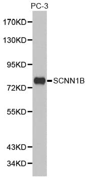 SCNN1B / ENaC Beta Antibody