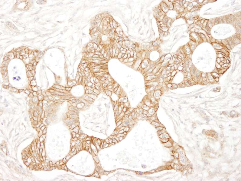 CTNNB1 / Beta Catenin Antibody (aa760-781)