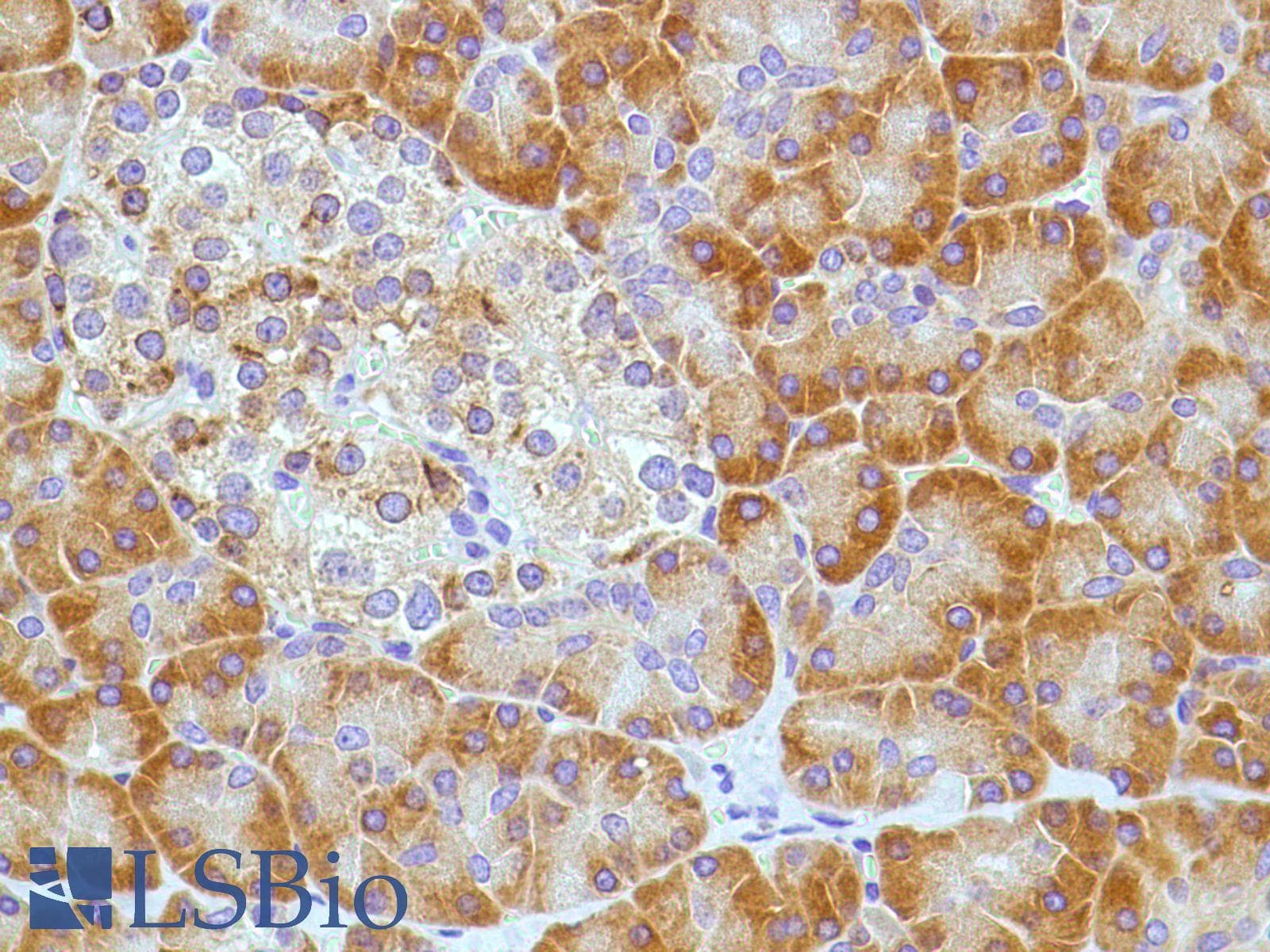 PTGS2 / COX2 / COX-2 Antibody (C-Terminus, clone SP21)