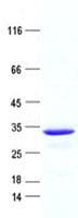 Human PDZD9 Protein (Recombinant His, N-Terminal)