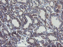 Monoclonal Mouse anti-Human MYL7 Antibody (clone 4.00E+07, Carrier-free, IHC, WB)