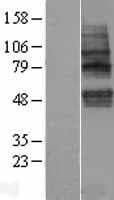 TMEM117 Protein (Over-Expression Lysate Myc-DDK (Flag))