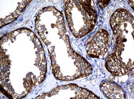 NME1 / NM23 Antibody (clone OTI3F2, Carrier-free)