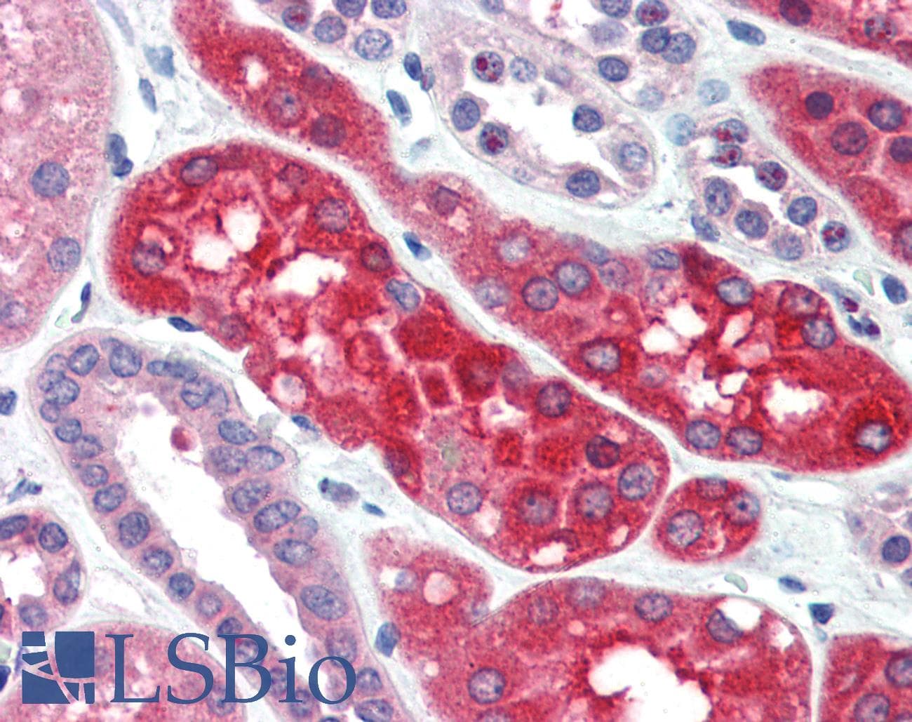 IHC-plus™ EZR / Ezrin Antibody (aa352-363)