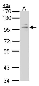 IHC-plus™ Polyclonal Rabbit anti-Human Glucocorticoid Receptor Beta Antibody (N-Terminus, IHC, WB)