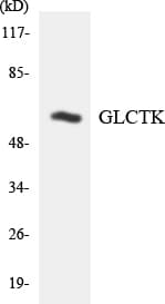 Polyclonal Rabbit anti-Human GLYCTK / Glycerate Kinase Antibody (aa91-140, IHC, WB)