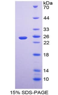 Human LAT Protein (Recombinant His-T7)