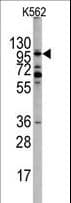 Polyclonal Rabbit anti-Human EPHA10 / EPH Receptor A10 Antibody (aa149-179, IHC, WB)