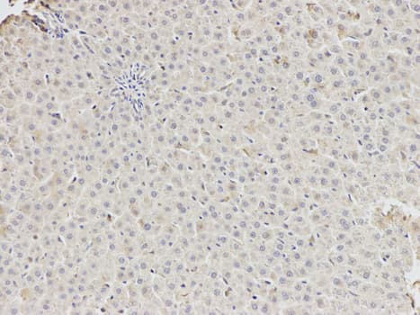 DDX5 Antibody