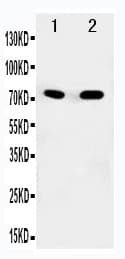 Polyclonal Rabbit anti-Human SDHA Antibody (aa113-128, WB)