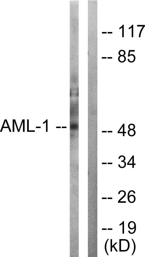 AML1 / RUNX1 Antibody (p303)
