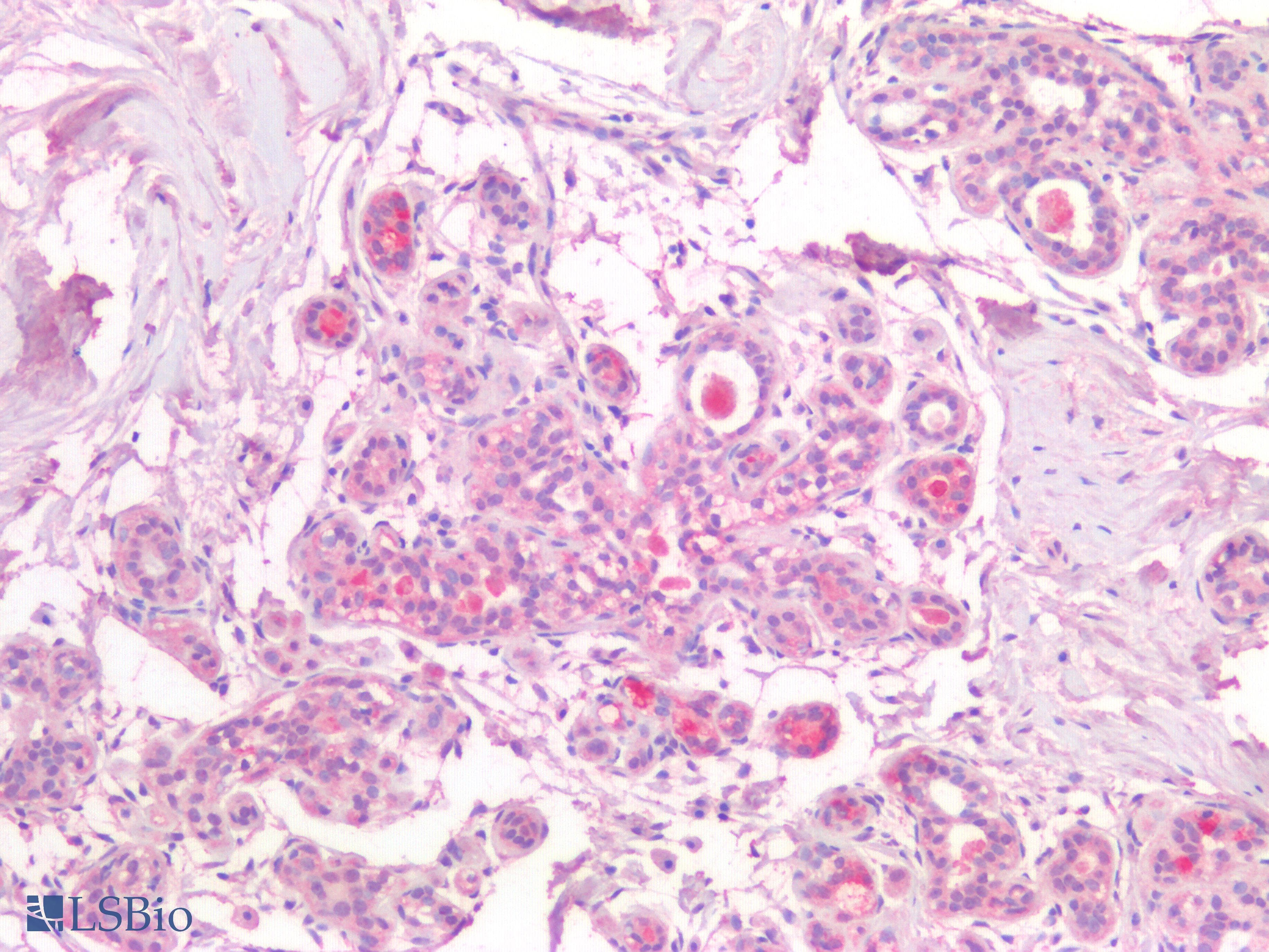 IHC-plus™ Polyclonal Rabbit anti-Human SCGB2A2 / Mammaglobin A Antibody (Internal, IHC, IF, WB)