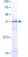 Human AQP8 / Aquaporin 8 Protein (Recombinant GST)