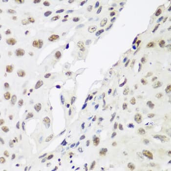 CBX3 / HP1 Gamma Antibody