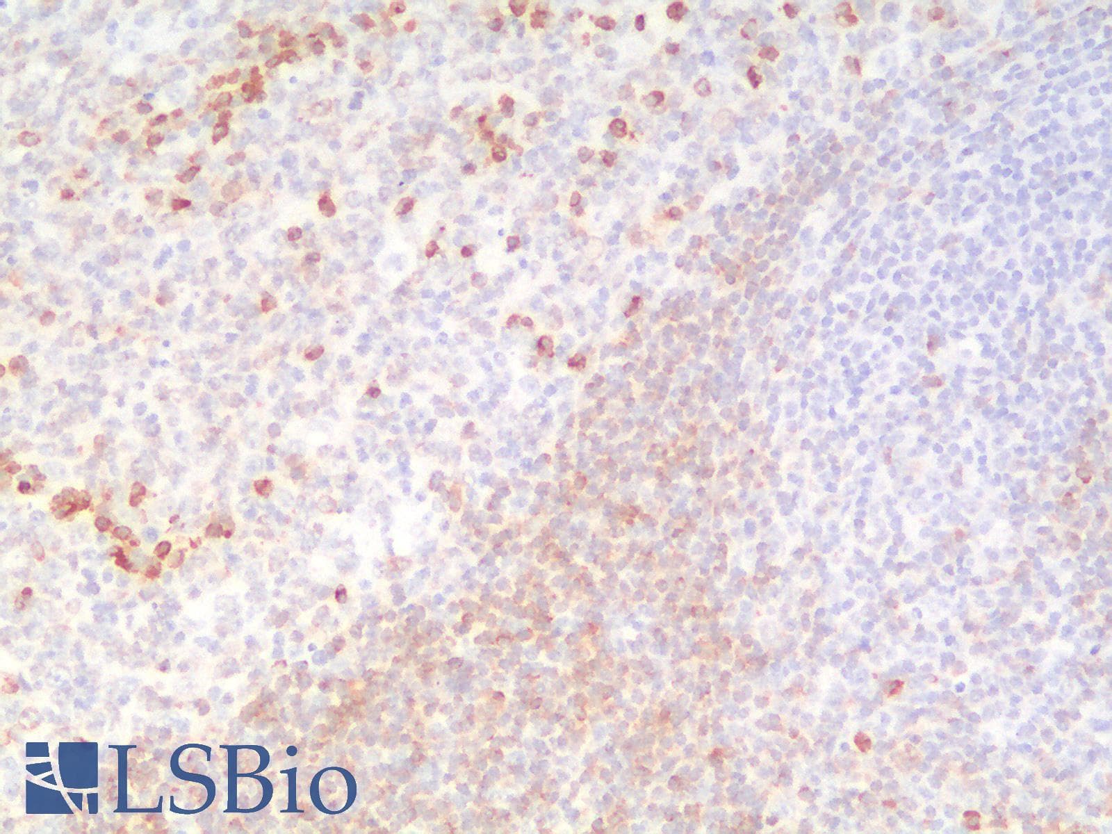 PathPlus™ CD79A / CD79 Alpha Antibody (aa202-216, clone IGA/1790R)