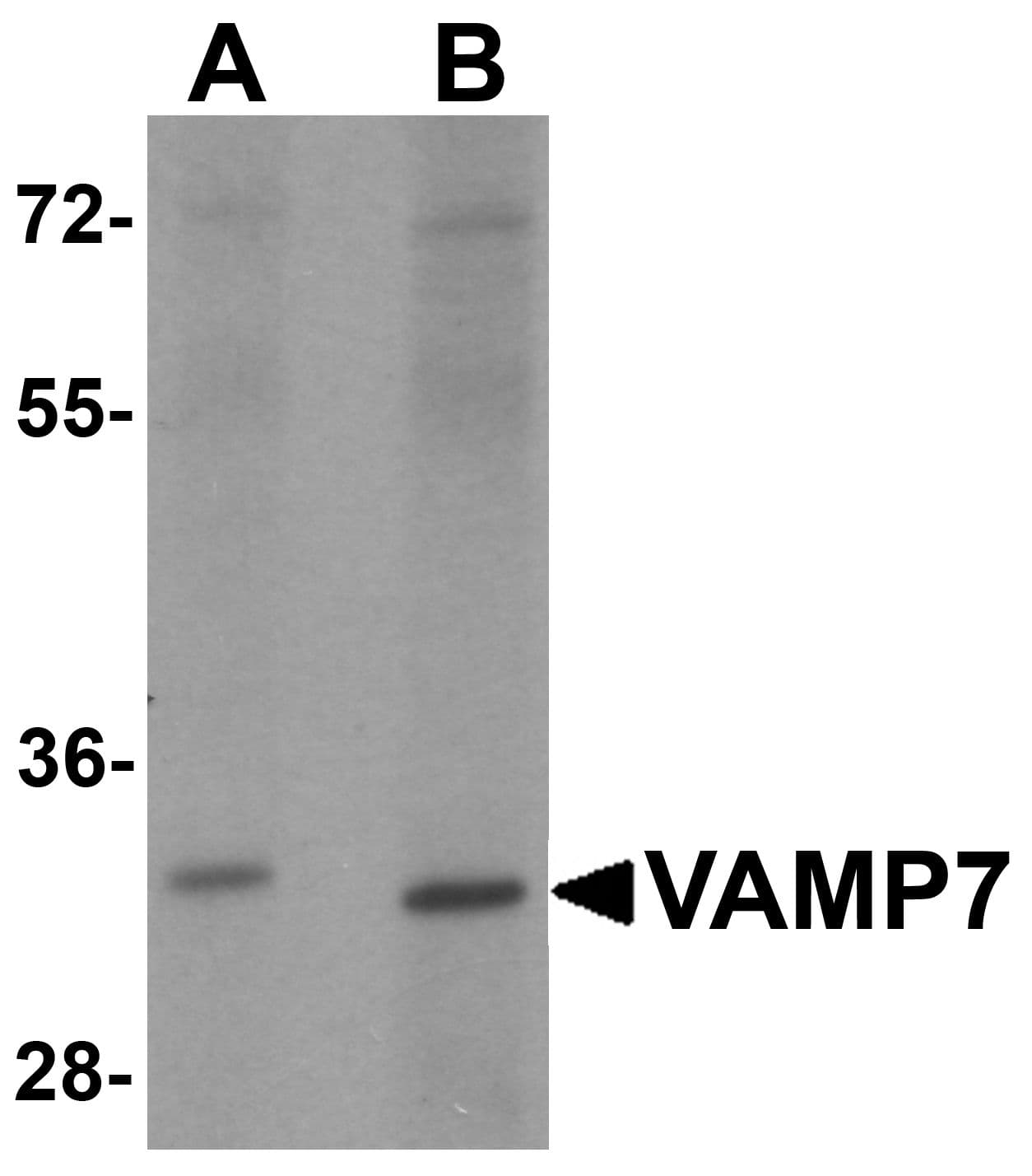 IHC-plus™ VAMP7 / SYBL1 / T1 VAMP Antibody