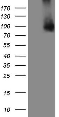 GPNMB / Osteoactivin Antibody (clone OTI5C2)