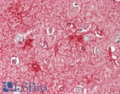 IHC-plus™ CRHR2 / CRF2 Receptor Antibody (His112)