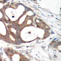 Polyclonal Rabbit anti-Human ER Alpha / Estrogen Receptor Antibody (Internal, IHC, IF, WB)