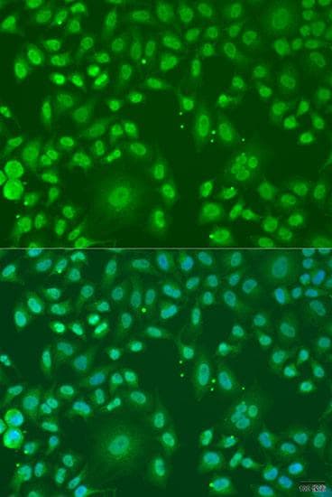 ARL6 Antibody