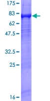 Human XRN1 Protein (Recombinant GST)