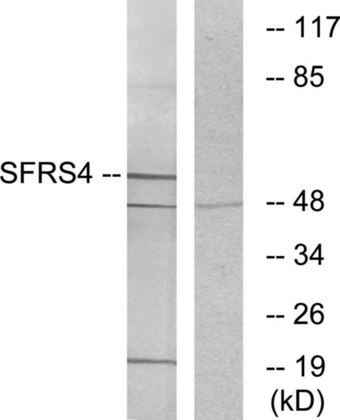 SRSF4 / SFRS4 Antibody (aa111-160)