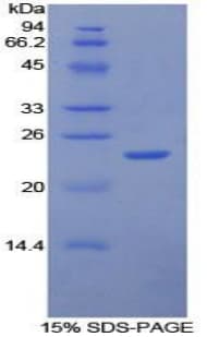 Human ICAM4 / CD242 Protein (Recombinant His, N-Terminal)