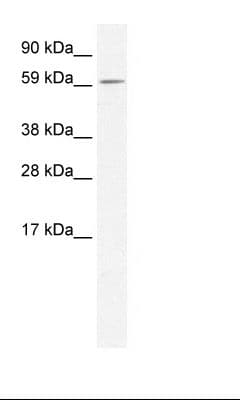 ARA55 / HIC-5 Antibody (aa179-228)