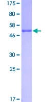 Human ARHGDIA / RHOGDI Protein (Recombinant GST)