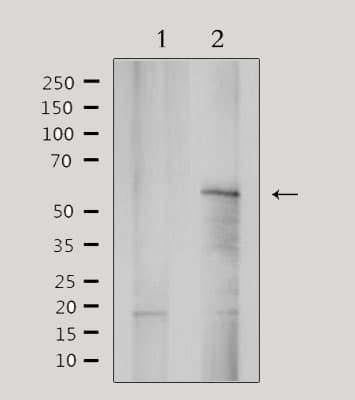 YTHDF1 Antibody